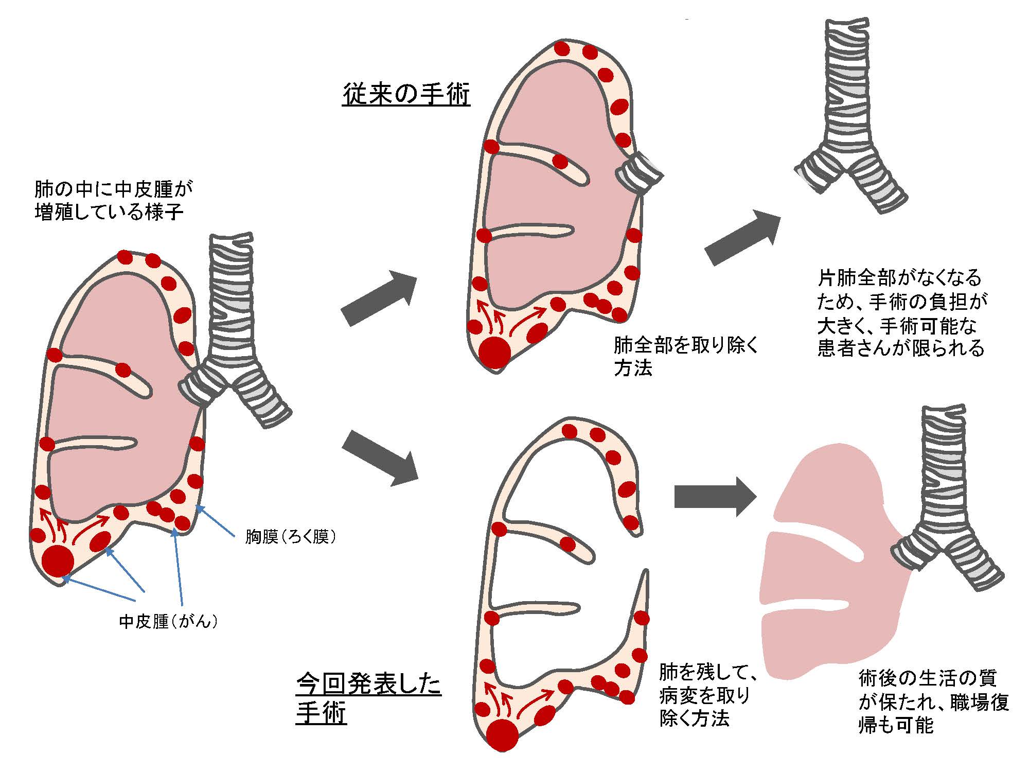 手術